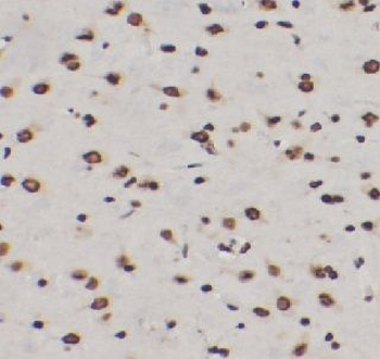SOD1 Mouse Monoclonal Antibody