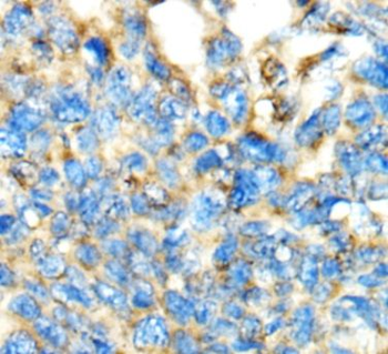 ACC1 Mouse Monoclonal Antibody