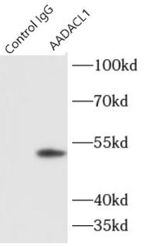 NCEH1 Antibody