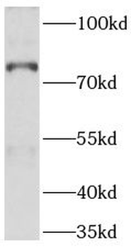 ABCD1 Mouse Monoclonal Antibody