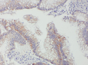 ACADL Specific Rabbit Polyclonal Antibody