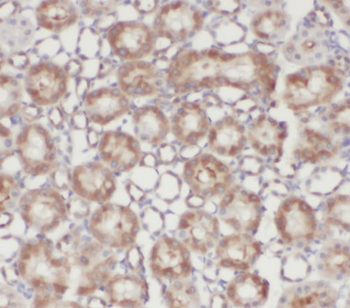 ACOT9 Rabbit Polyclonal Antibody