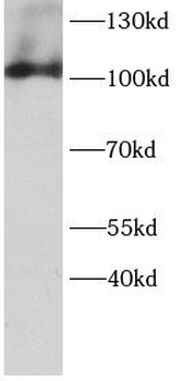 AVIL Antibody