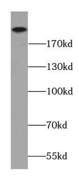 AFDN Antibody