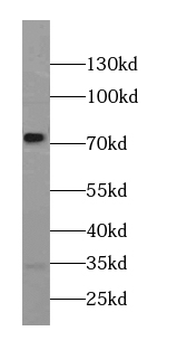 GPSM1 Rabbit Polyclonal Antibody