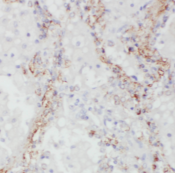 GPSM1 Rabbit Polyclonal Antibody