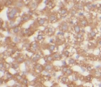 AK2 Mouse Monoclonal Antibody