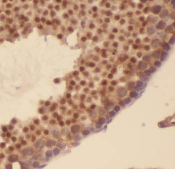 AKAP3 Mouse Monoclonal Antibody