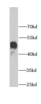 SERPINA3 Rabbit Polyclonal Antibody