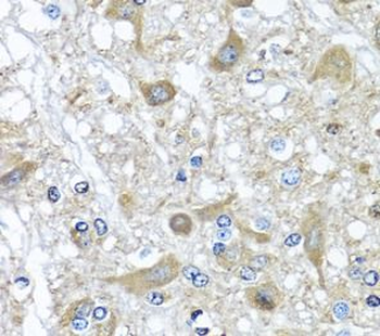 SERPINA3 Rabbit Polyclonal Antibody