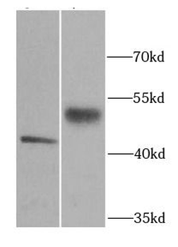 SERPINA1 Rabbit Polyclonal Antibody