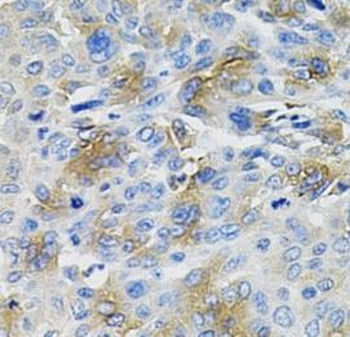 SERPINA1 Rabbit Polyclonal Antibody