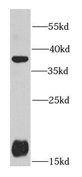 PRKAB1 Rabbit Polyclonal Antibody