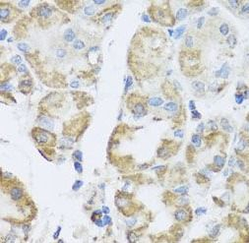 PRKAG1 Rabbit Polyclonal Antibody