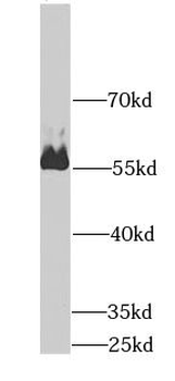 AMY2A Rabbit Polyclonal Antibody