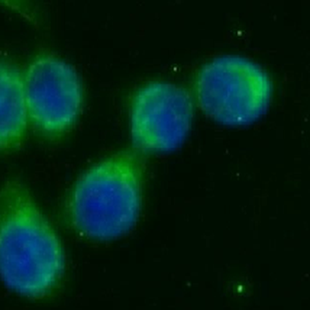 AMY2A Mouse Monoclonal Antibody