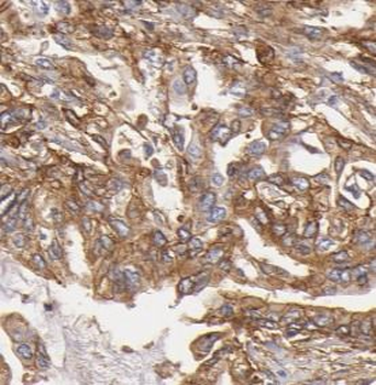 AMY2A Mouse Monoclonal Antibody