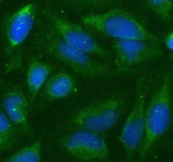ANKLE1 Antibody
