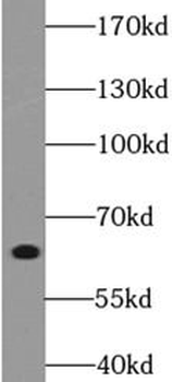 ANKLE1 Rabbit Polyclonal Antibody