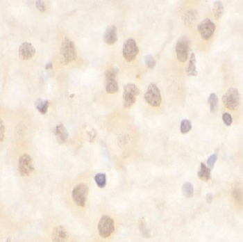 ANKLE1 Rabbit Polyclonal Antibody