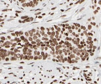 JUN Rabbit Polyclonal Antibody