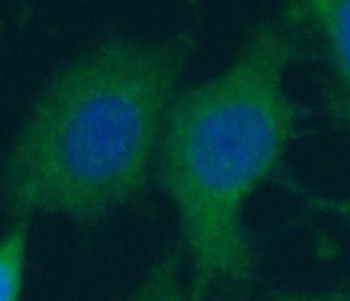 ARPC5L Rabbit Polyclonal Antibody