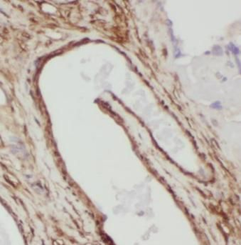 ARPC5L Rabbit Polyclonal Antibody