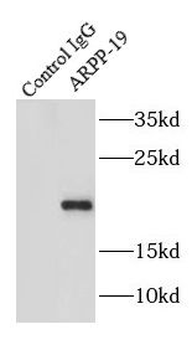 ARPP19 Antibody