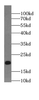 ARPP19 Rabbit Polyclonal Antibody