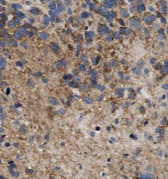 ARPP19 Rabbit Polyclonal Antibody