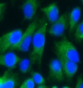 ATP5F1A Antibody