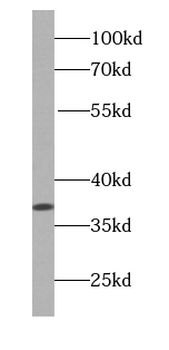 NPM1 Antibody