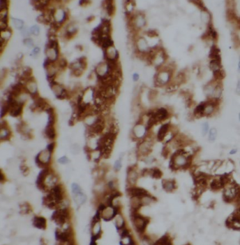 BBS5 Mouse Monoclonal Antibody