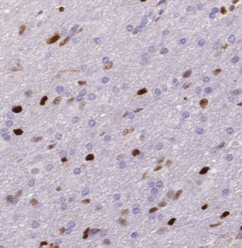 CELF5 Rabbit Polyclonal Antibody