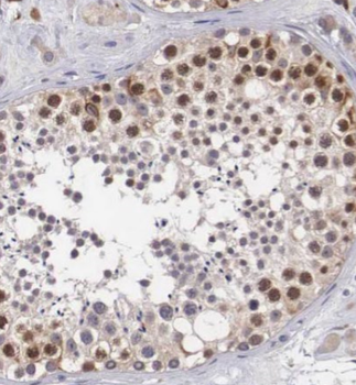 SDHAF2 Rabbit Polyclonal Antibody