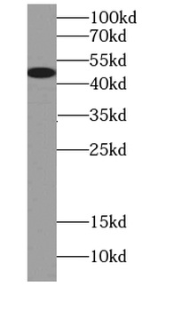 VIPAS39 Antibody