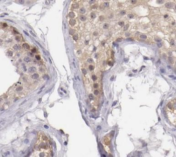 VCPKMT Rabbit Polyclonal Antibody