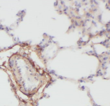 HAUS4 Rabbit Polyclonal Antibody