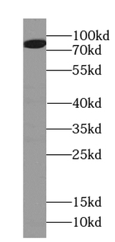 HID1 Rabbit Polyclonal Antibody