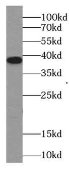 TMEM241 Antibody