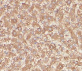 TIMM21 Antibody