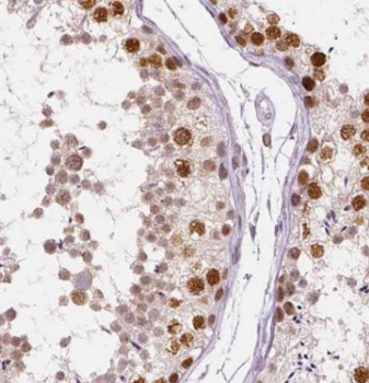 SYCE3 Antibody