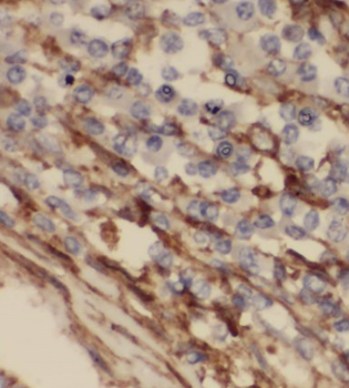 BRK1 Antibody