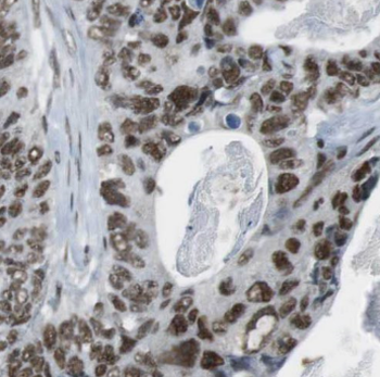 CPED1 Rabbit Polyclonal Antibody