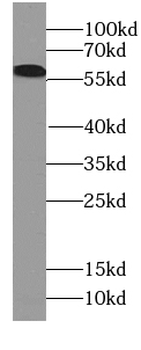 CCIN Antibody