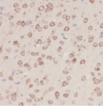 CAMK2D Specific Rabbit Polyclonal Antibody