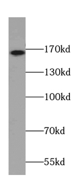 CAMSAP2 Rabbit Polyclonal Antibody