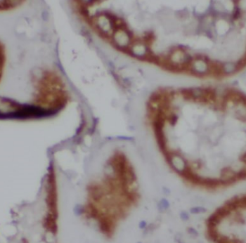 CAMSAP2 Rabbit Polyclonal Antibody