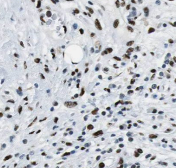 CPA6 Rabbit Polyclonal Antibody