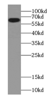 Catalase Specific Rabbit Polyclonal Antibody